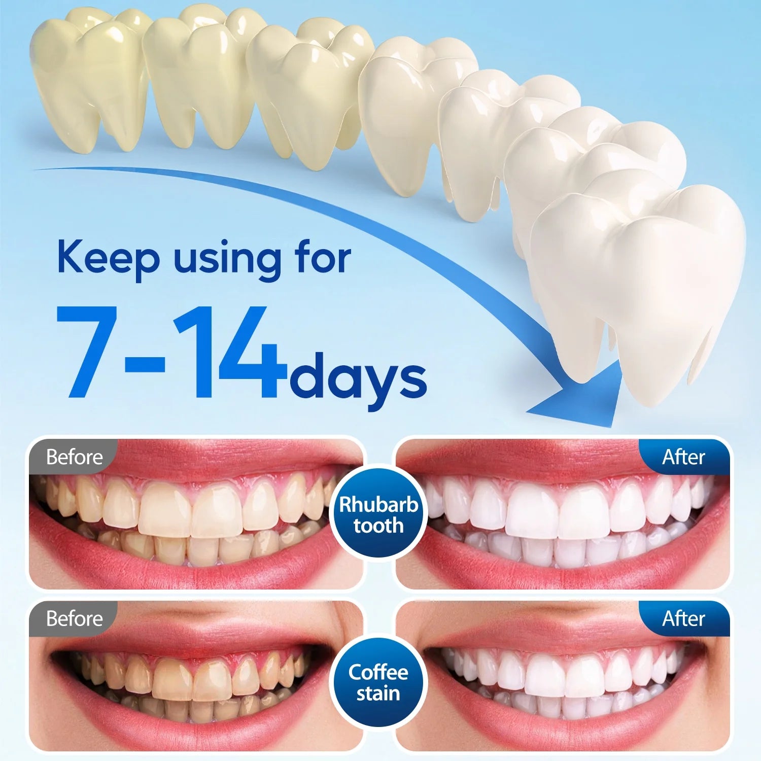 LED Teeth Whitening Kit for Sensitive Teeth - 22% Carbamide Peroxide Gel with 24 Blue Light Accelerator, 16Min Rapid White At-Home Dental Care for Smoking & Coffee Stains