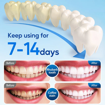 LED Teeth Whitening Kit for Sensitive Teeth - 22% Carbamide Peroxide Gel with 24 Blue Light Accelerator, 16Min Rapid White At-Home Dental Care for Smoking & Coffee Stains